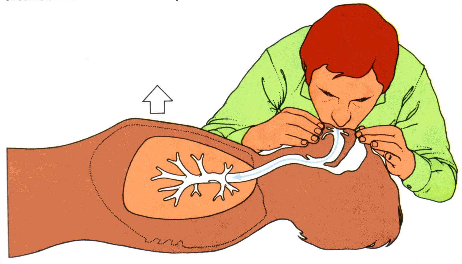 cpr image cpr image