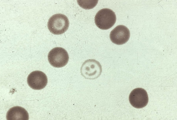 Red Blood Cells