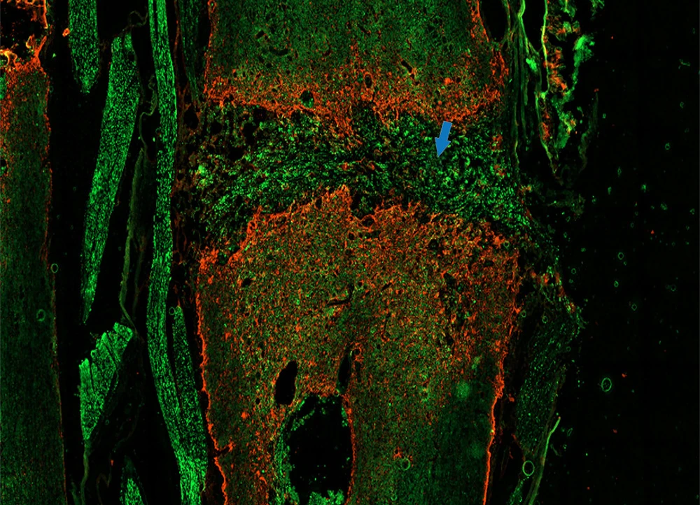 visualization of an injured spinal cord